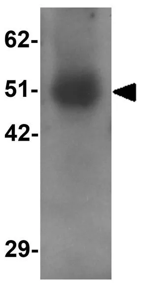WB analysis of human lung tissue lysate using GTX32014 RASSF10 antibody. Working concentration : 1 microg/ml