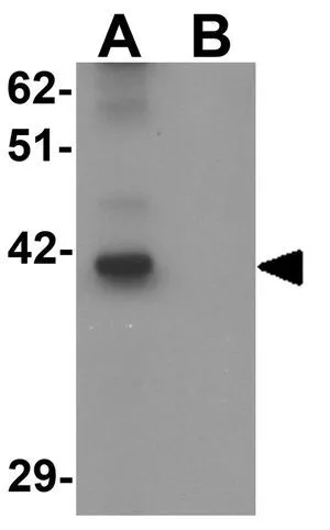 ICC/IF analysis of K562 cells using GTX32015 TRMT12 antibody. Working concentration : 10 ug/ml