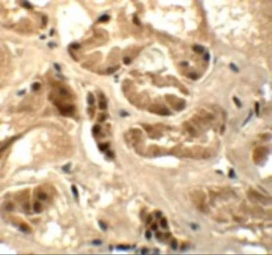 IHC-P analysis of human kidney tissue using GTX32018 ATAD3B antibody. Working concentration : 5 microg/ml IHC-P analysis of human kidney tissue using GTX32018 ATAD3B antibody. Working concentration : 5 microg/ml