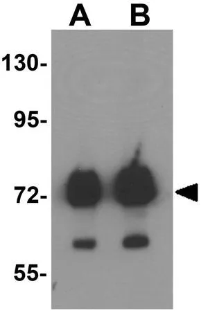 WB analysis of human kidney tissue lysate using GTX32018 ATAD3B antibody. Working concentration : (A) 1 and (B) 2 microg/ml