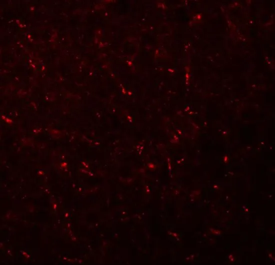 IHC-P analysis of mouse brain tissue using GTX32019 AP3M1 antibody. Working concentration : 5 ug/ml
