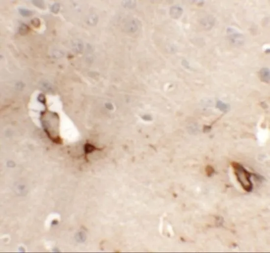 IHC-P analysis of mouse brain tissue using GTX32025 TMEM204 antibody. Working concentration : 5 microg/ml IHC-P analysis of mouse brain tissue using GTX32025 TMEM204 antibody. Working concentration : 5 microg/ml