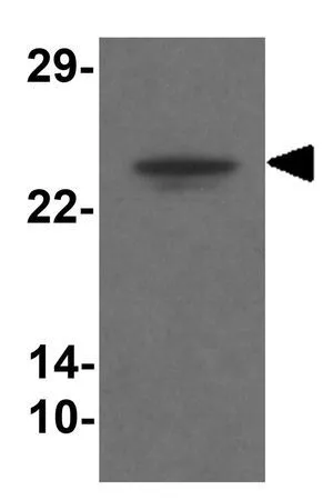 WB analysis of human brain tissue lysate using GTX32025 TMEM204 antibody. Working concentration : 1 microg/ml