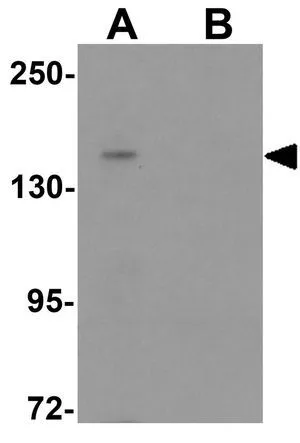 WB analysis of Jurkat cell lysate in (A) the absence and (B) the presence of blocking peptide using GTX32026 L1TD1 antibody. Working concentration : 1 ug/ml