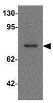 WB analysis of MCF7 cell lysate using GTX32027 PALM3 antibody. Working concentration : 1 microg/ml WB analysis of MCF7 cell lysate using GTX32027 PALM3 antibody. Working concentration : 1 microg/ml