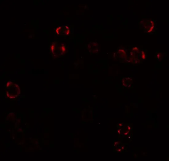 ICC/IF analysis of MCF7 cells using GTX32027 PALM3 antibody. Working concentration : 20 microg/ml