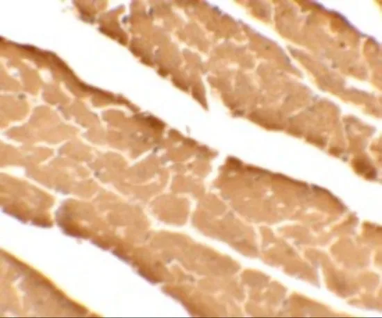 IHC-P analysis of mouse heart tissue using GTX32030 Sec62 antibody. Working concentration : 5 microg/ml IHC-P analysis of mouse heart tissue using GTX32030 Sec62 antibody. Working concentration : 5 microg/ml