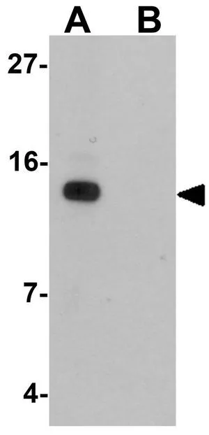 WB analysis of mouse heart tissue lysate in (A) the absence and (B) the presence of blocking peptide using GTX32030 Sec62 antibody. Working concentration : 1 microg/ml