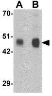 WB analysis of rat cerebellum tissue lysate using GTX32031 RILPL1 antibody. Working concentration : (A) 0.5 and (B) 1 microg/ml WB analysis of rat cerebellum tissue lysate using GTX32031 RILPL1 antibody. Working concentration : (A) 0.5 and (B) 1 microg/ml
