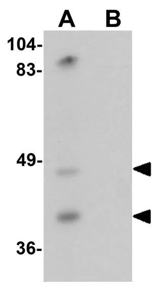 WB analysis of mouse liver tissue lysate in (A) the absence and (B) the presence of blocking peptide using GTX32036 TMPRSS11A antibody. Working concentration : 1 microg/ml WB analysis of mouse liver tissue lysate in (A) the absence and (B) the presence of blocking peptide using GTX32036 TMPRSS11A antibody. Working concentration : 1 microg/ml