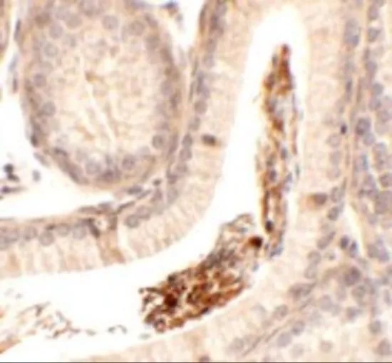 IHC-P analysis of mouse testis tissue using GTX32038 SPATA1 antibody. Working concentration : 2.5 microg/ml IHC-P analysis of mouse testis tissue using GTX32038 SPATA1 antibody. Working concentration : 2.5 microg/ml