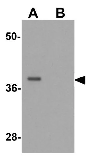WB analysis of A549 cell lysate in (A) the absence and (B) the presence of blocking peptide using GTX32042 PRICKLE4 antibody. Working concentration : 0.25 microg/ml WB analysis of A549 cell lysate in (A) the absence and (B) the presence of blocking peptide using GTX32042 PRICKLE4 antibody. Working concentration : 0.25 microg/ml