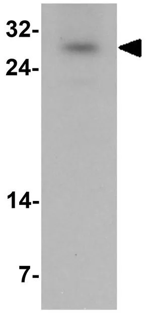 WB analysis of mouse liver tissue lysate using GTX32046 SIVA antibody. Working concentration : 1 microg/ml WB analysis of mouse liver tissue lysate using GTX32046 SIVA antibody. Working concentration : 1 microg/ml