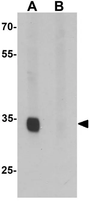 WB analysis of A549 cell lysate in (A) the absence and (B) the presence of blocking peptide using GTX32052 SLAIN1 antibody. Working concentration : 1 microg/ml WB analysis of A549 cell lysate in (A) the absence and (B) the presence of blocking peptide using GTX32052 SLAIN1 antibody. Working concentration : 1 microg/ml