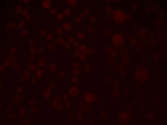 ICC/IF analysis of A549 cells using GTX32052 SLAIN1 antibody. Working concentration : 2.5 microg/ml