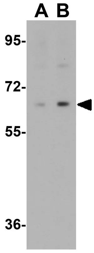 WB analysis of HeLa cell lysate in (A) the absence and (B) the presence of blocking peptide using GTX32054 IRF2BP2 antibody. Working concentration : 1 microg/ml WB analysis of HeLa cell lysate in (A) the absence and (B) the presence of blocking peptide using GTX32054 IRF2BP2 antibody. Working concentration : 1 microg/ml
