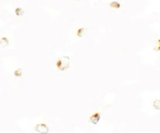 ICC/IF analysis of 293 cells using GTX32055 B9D1 antibody. Working concentration : 5 microg/ml