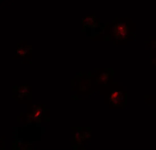 ICC/IF analysis of 293 cells using GTX32055 B9D1 antibody. Working concentration : 20 microg/ml