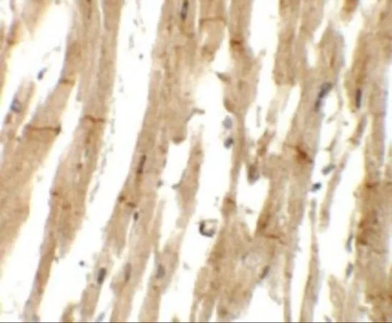 IHC-P analysis of human heart tissue using GTX32056 MLIP antibody. Working concentration : 5 microg/ml IHC-P analysis of human heart tissue using GTX32056 MLIP antibody. Working concentration : 5 microg/ml