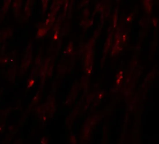 IHC-P analysis of human heart tissue using GTX32056 MLIP antibody. Working concentration : 20 microg/ml