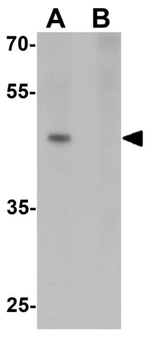 WB analysis of 293 cell lysate in (A) the absence and (B) the presence of blocking peptide using GTX32056 MLIP antibody. Working concentration : 1 microg/ml