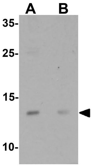 WB analysis of A-20 cell lysate in (A) the absence and (B) the presence of blocking peptide using GTX32057 C9orf116 antibody. Working concentration : 1 microg/ml WB analysis of A-20 cell lysate in (A) the absence and (B) the presence of blocking peptide using GTX32057 C9orf116 antibody. Working concentration : 1 microg/ml