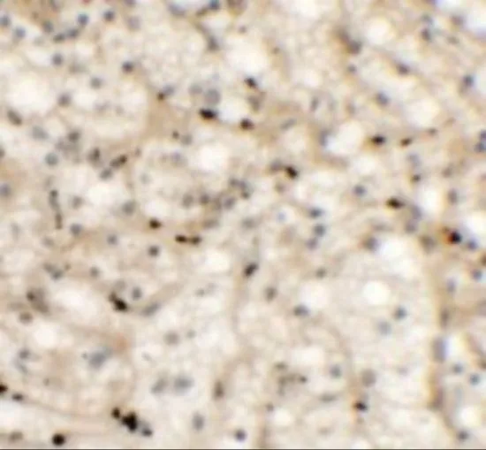 IHC-P analysis of human spleen tissue using GTX32059 Nkx2.6 antibody. Working concentration : 5 microg/ml IHC-P analysis of human spleen tissue using GTX32059 Nkx2.6 antibody. Working concentration : 5 microg/ml