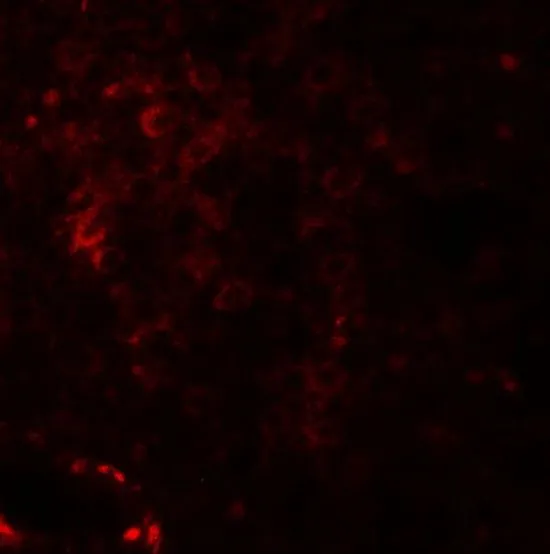 IHC-P analysis of human spleen tissue using GTX32059 Nkx2.6 antibody. Working concentration : 20 microg/ml