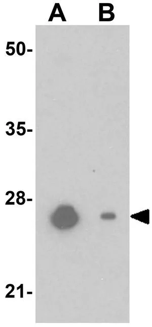 WB analysis of mouse heart tissue lysate in (A) the absence and (B) the presence of blocking peptide using GTX32059 Nkx2.6 antibody. Working concentration : 1 microg/ml