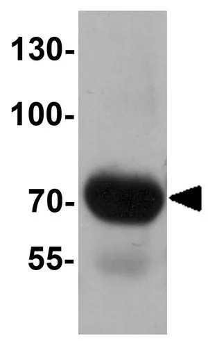 WB analysis of human lung tissue lysate using GTX32060 FOXRED2 antibody. Working concentration : 1 microg/ml WB analysis of human lung tissue lysate using GTX32060 FOXRED2 antibody. Working concentration : 1 microg/ml
