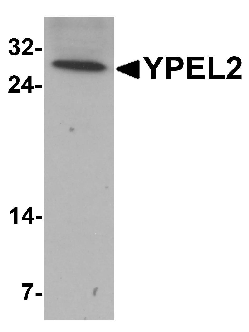 WB analysis of HeLa cell lysate using GTX32063 YPEL2 antibody. Dilution : 1 microg/ml WB analysis of HeLa cell lysate using GTX32063 YPEL2 antibody. Dilution : 1 microg/ml