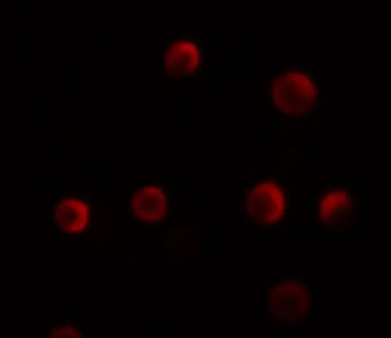 ICC/IF analysis of HeLa cells using GTX32063 YPEL2 antibody. Working concentration : 5 microg/ml
