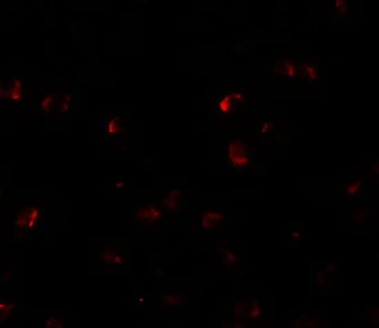 ICC/IF analysis of A-20 cells using GTX32064 YPEL3 antibody. Working concentration : 5 microg/ml