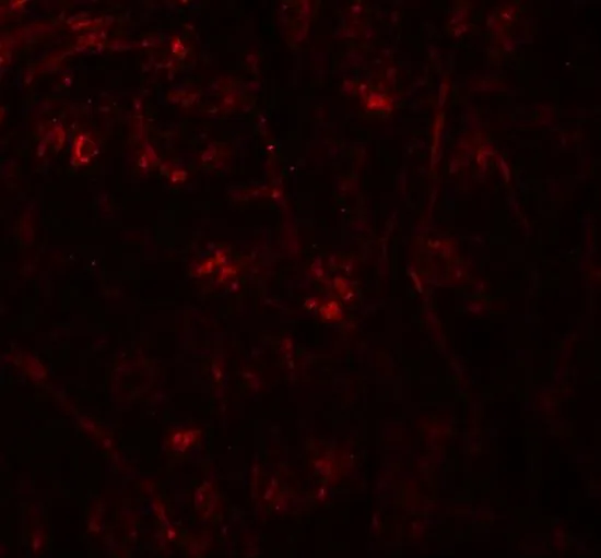 IHC-P analysis of mouse brain tissue using GTX32066 TMEM106A antibody. Working concentration : 20 microg/ml
