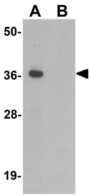 WB analysis of A-20 cell lysate in (A) the absence and (B) the presence of blocking peptide using GTX32066 TMEM106A antibody. Working concentration : 1 microg/ml