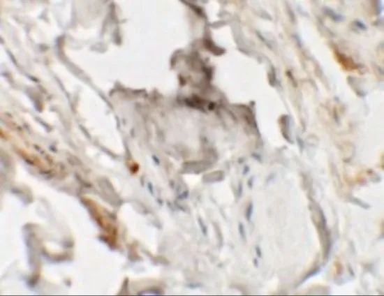 IHC-P analysis of human skin tissue using GTX32068 HHATL antibody. Working concentration : 2.5 microg/ml IHC-P analysis of human skin tissue using GTX32068 HHATL antibody. Working concentration : 2.5 microg/ml