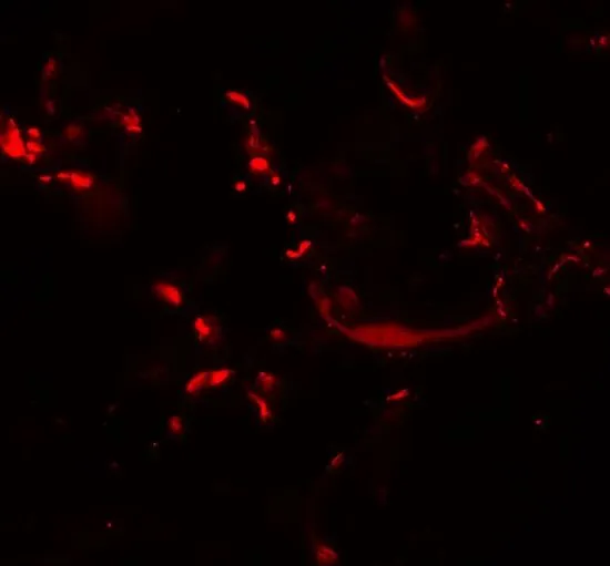 IHC-P analysis of human skin tissue using GTX32068 HHATL antibody. Working concentration : 20 microg/ml