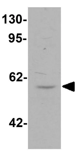 WB analysis of 3T3 cell lysate using GTX32068 HHATL antibody. Working concentration : 1 microg/ml
