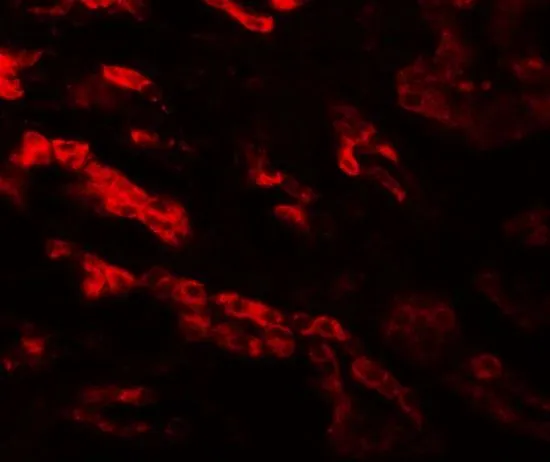 IHC-P analysis of human kidney tissue using GTX32070 GZF1 antibody. Working concentration : 20 microg/ml