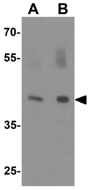 WB analysis of rat lung tissue lysate using GTX32071 WDR18 antibody. Working concentration : (A) 1 and (B) 2 microg/ml