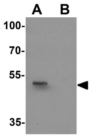 WB analysis of rat brain tissue lysate in (A) the absence and (B) the presence of blocking peptide using GTX32077 KIAA0141 antibody. Working concentration : 1 microg/ml