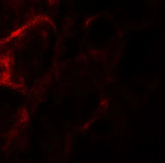 IHC-P analysis of human kidney tissue using GTX32080 ZFYVE21 antibody. Working concentration : 20 microg/ml IHC-P analysis of human kidney tissue using GTX32080 ZFYVE21 antibody. Working concentration : 20 microg/ml