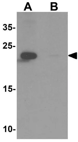 WB analysis of 3T3 cell tissue lysate in (A) the absence and (B) the presence of blocking peptide using GTX32080 ZFYVE21 antibody. Working concentration : 1 microg/ml