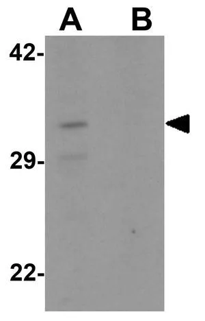 WB analysis of K562 cell lysate in (A) the absence and (B) the presence of blocking peptide using GTX32085 CLEC2A antibody. Working concentration : 1 microg/ml WB analysis of K562 cell lysate in (A) the absence and (B) the presence of blocking peptide using GTX32085 CLEC2A antibody. Working concentration : 1 microg/ml