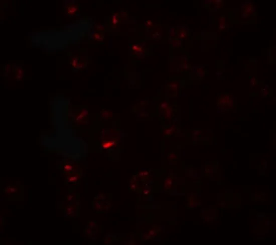 ICC/IF analysis of K562 cells using GTX32085 CLEC2A antibody. Working concentration : 20 microg/ml