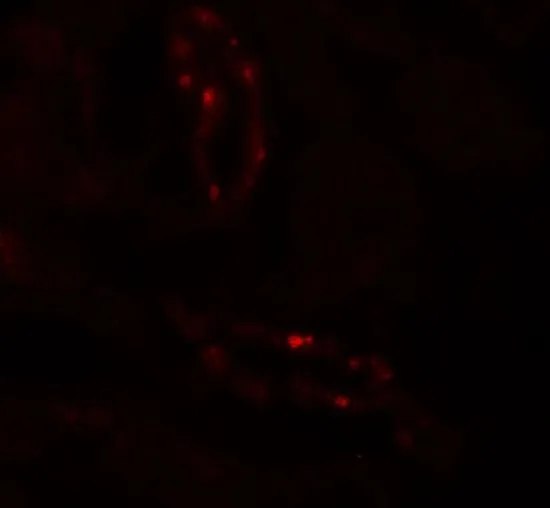 IHC-P analysis of human kidney tissue using GTX32089 SCUBE3 antibody. Working concentration : 20 microg/ml IHC-P analysis of human kidney tissue using GTX32089 SCUBE3 antibody. Working concentration : 20 microg/ml