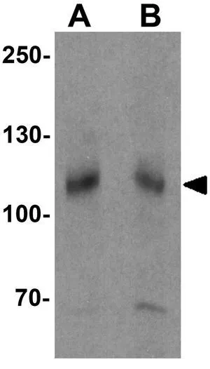 WB analysis of mouse kidney tissue lysate using GTX32089 SCUBE3 antibody. Working concentration : (A) 1 and (B) 2 microg/ml