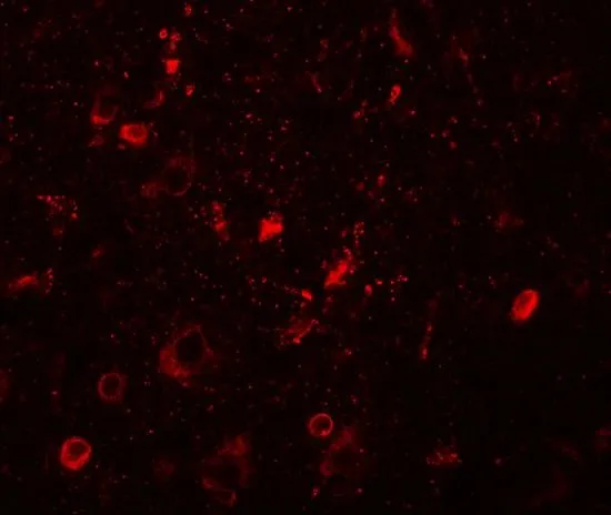 IHC-P analysis of human brain tissue using GTX32093 SGSM1 antibody. Working concentration : 20 microg/ml IHC-P analysis of human brain tissue using GTX32093 SGSM1 antibody. Working concentration : 20 microg/ml