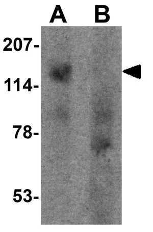 WB analysis of human cerebellum tissue lysate in (A) the absence and (B) the presence of blocking peptide using GTX32093 SGSM1 antibody. Working concentration : 1 microg/ml