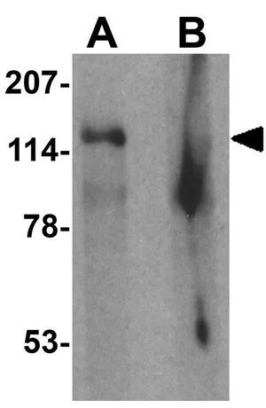WB analysis of human cerebellum tissue lysate in (A) the absence and (B) the presence of blocking peptide using GTX32094 SGSM2 antibody. Working concentration : 1 microg/ml